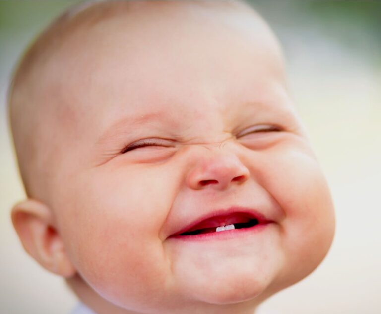 Corporativo Kosmos ofrece apoyo a niños con labio hendido